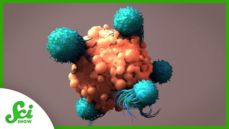 10 Year Cancer Remission Thanks to T Cell Therapy , Sci Show