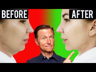 Fastest Way to Rid Your DOUBLE CHIN (Turkey Neck)